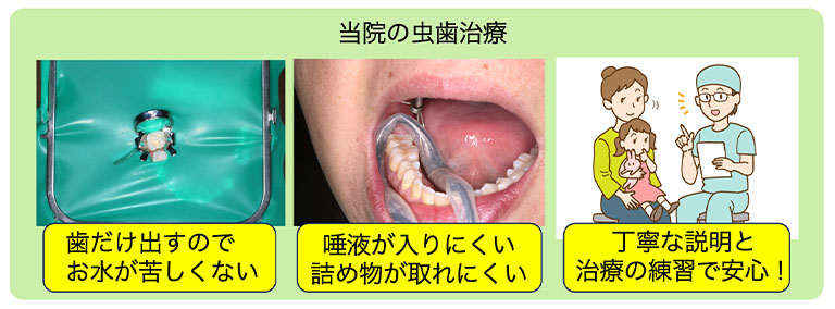 当院の虫歯治療